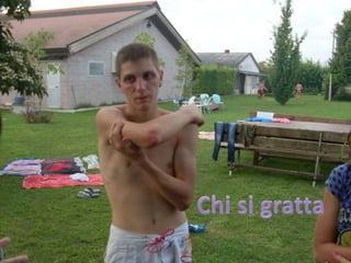  Chi si gratta