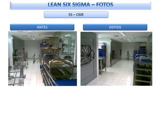 5S – CME


ANTES              DEPOIS
 