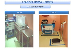 ALA DE INTERNAÇÃO


ANTES                       DEPOIS
 