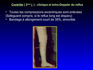 Contrôle  ( 3 ème  j. ) : clinique et écho-Doppler du reflux Toutes les compressions excentriques sont enlevées  (Safeguard compris, si le reflux long est disparu)  Bandage à allongement court de 35%, amovible 