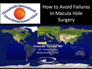Borgomanero
How to Avoid Failures
in Macula Hole
Surgery
Vincenzo Ferrara, MD
SS. Trinità Hospital
Borgomanero - ITALY
 