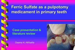 Ferric Sulfate as a pulpotomy
medicament in primary teeth
Case presentation &
literature review
Osama H. AlKhalifa
 