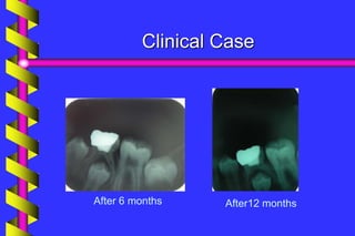 Clinical Case
After 6 months After12 months
 