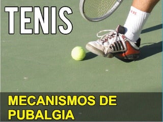 MecanismosMecanismos
de Pubalgiade Pubalgia
en Tenisen Tenis
 