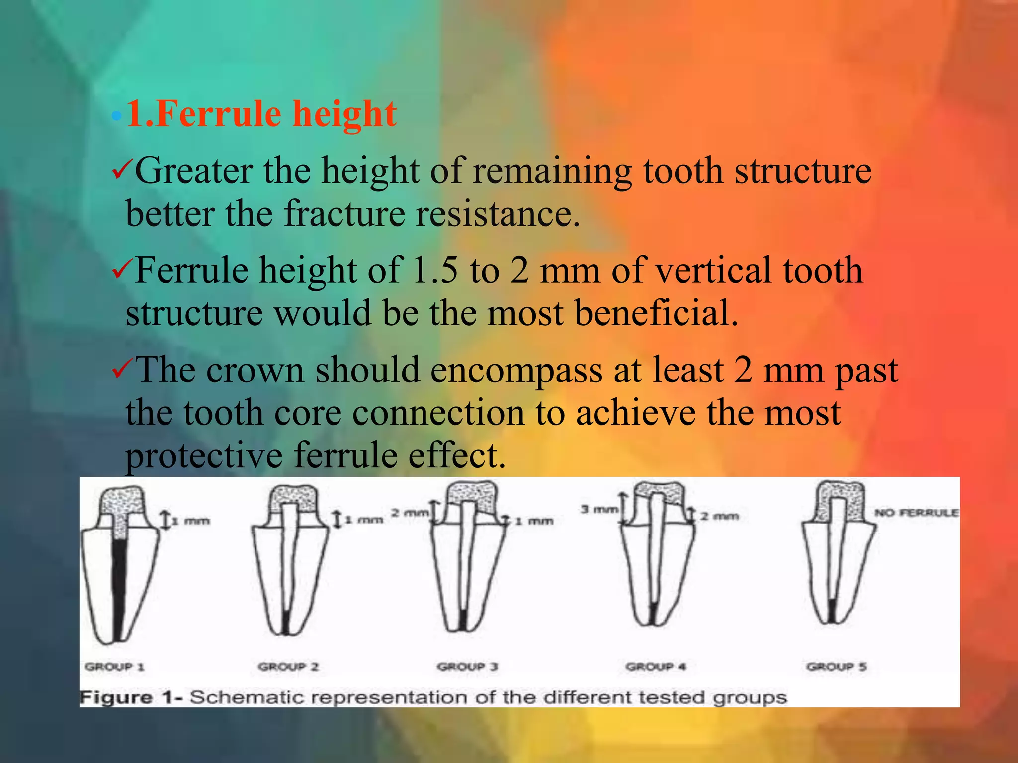 Ferrule 3 | PPTX