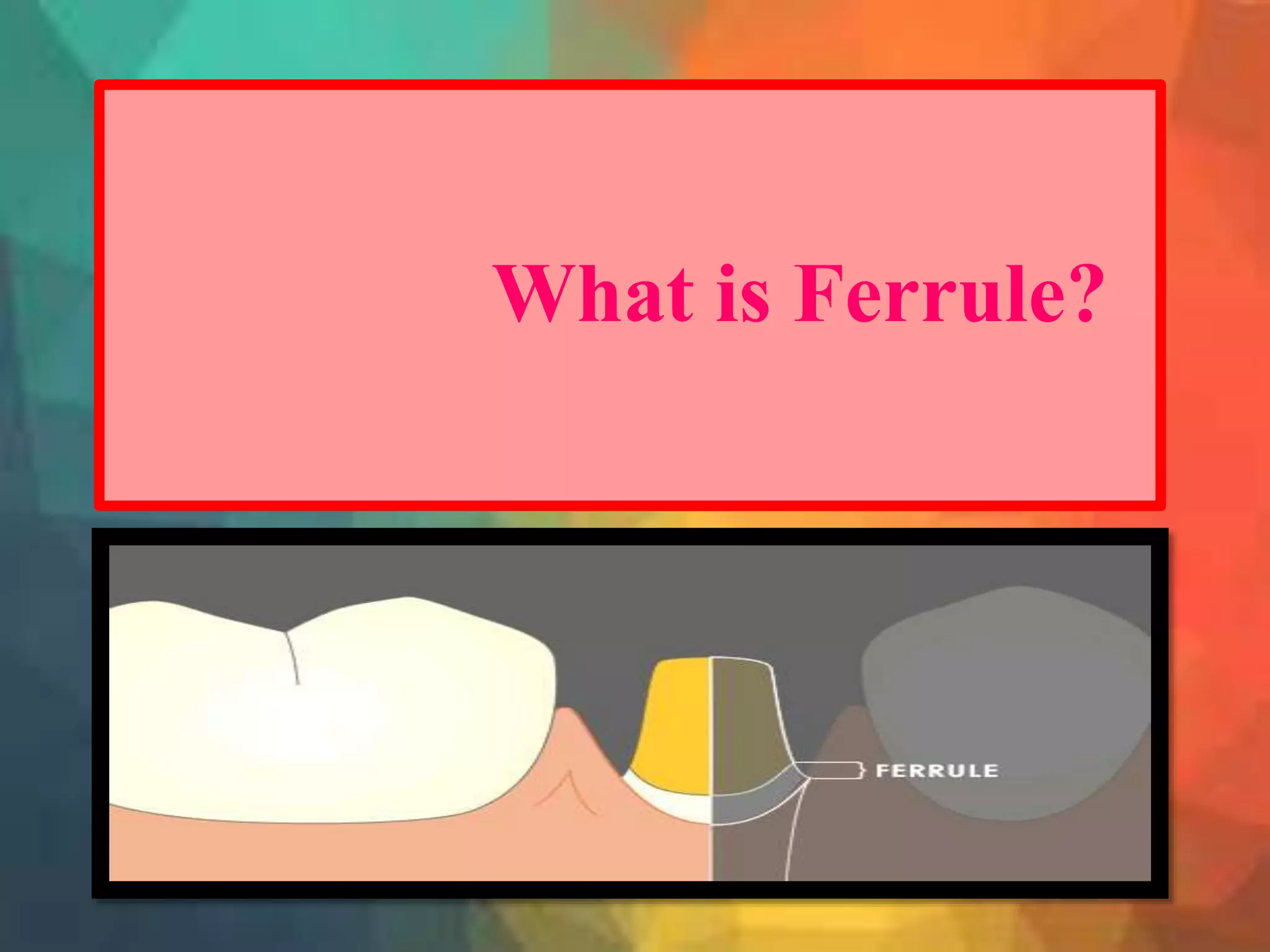 Ferrule 3 | PPTX