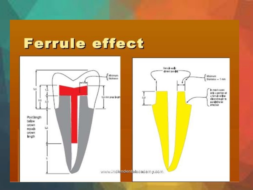 Ferrule 3