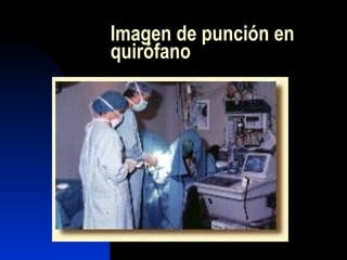 Imagen de punción en quirófano  
