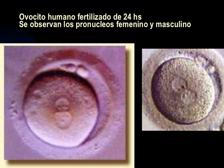 Fertilidad asistida