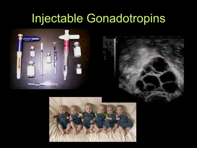 Fertility Options: IVF Overview | PPT | Free Download