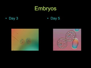 Embryos Day 3 Day 5 