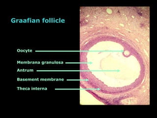 Graafian follicle Oocyte Membrana granulosa Theca   interna Basement membrane Antrum 