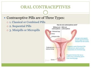 ORAL CONTRACEPTIVES
 Contraceptive Pills are of Three Types:
 1. Classical or Combined Pills
 2. Sequential Pills
 3. Minipills or Micropills
 