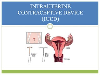 INTRAUTERINE
CONTRACEPTIVE DEVICE
(IUCD)
 