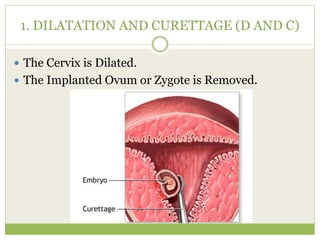 1. DILATATION AND CURETTAGE (D AND C)
 The Cervix is Dilated.
 The Implanted Ovum or Zygote is Removed.
 