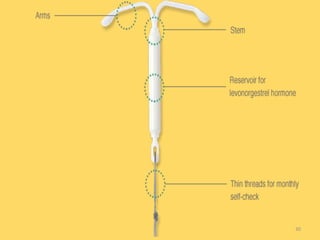 Fertility control (Contraception) | PPTX