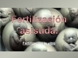  
Fertilización in vitro
 