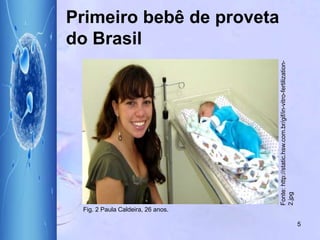 Primeiro bebê de proveta
do Brasil
Fig. 2 Paula Caldeira, 26 anos.
5
Fonte:http://static.hsw.com.br/gif/in-vitro-fertilization-
2.jpg
 