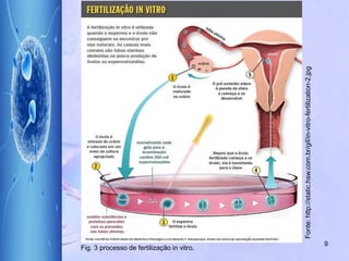 9
Fonte:http://static.hsw.com.br/gif/in-vitro-fertilization-2.jpg
Fig. 3 processo de fertilização in vitro.
 