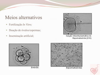 Meios alternativos
 Fertilização In Vitro;
 Doação de óvulos/espermas;
 Inseminação artificial;

 