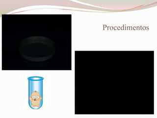 Procedimentos

 
