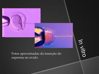 Fotos aproximadas da inserção do
esperma no ovulo.
 