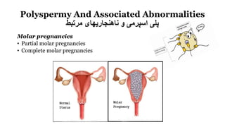 Polyspermy And Associated Abnormalities
‫مرتبط‬ ‫ناهنجاریهای‬ ‫و‬ ‫اسپرمی‬ ‫پلی‬
Molar pregnancies
• Partial molar pregnancies
• Complete molar pregnancies
 