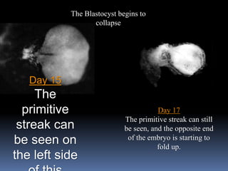Day 15
The
primitive
streak can
be seen on
the left side
Day 17
The primitive streak can still
be seen, and the opposite end
of the embryo is starting to
fold up.
The Blastocyst begins to
collapse
 