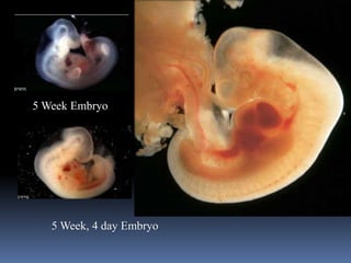5 Week Embryo
5 Week, 4 day Embryo
 