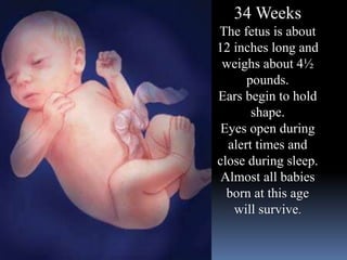 34 Weeks
The fetus is about
12 inches long and
weighs about 4½
pounds.
Ears begin to hold
shape.
Eyes open during
alert times and
close during sleep.
Almost all babies
born at this age
will survive.
 