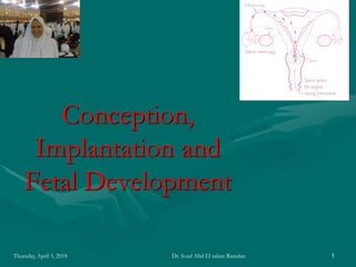 Conception,
Implantation and
Fetal Development
Thursday, April 5, 2018 1Dr. Soad Abd El salam Ramdan
 