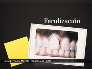 Ferulización




Luisa Fernanda Murillo – Odontóloga - UAM
 