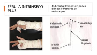 FERUULAS............................pptx