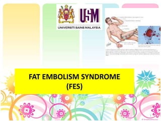 1 FAT EMBOLISM SYNDROME(FES)  