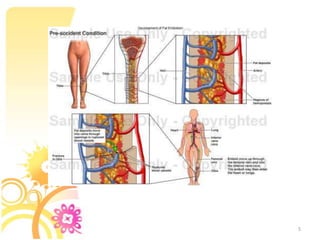 long bone fractures (1-20 %)