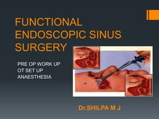 FUNCTIONAL
ENDOSCOPIC SINUS
SURGERY
PRE OP WORK UP
OT SET UP
ANAESTHESIA
Dr.SHILPA M J
 