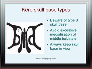 Kero skull base types
                       ●   Beware of type 3
                           skull base
                  ...