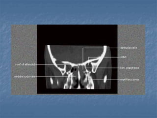 Fess complications presentation