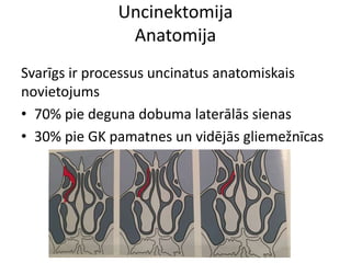 Uncinektomija
Anatomija
Svarīgs ir processus uncinatus anatomiskais
novietojums
• 70% pie deguna dobuma laterālās sienas
• 30% pie GK pamatnes un vidējās gliemežnīcas
 
