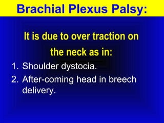 Brachial Plexus Palsy: 
It is due to over traction on 
the neck as in: 
1. Shoulder dystocia. 
2. After-coming head in breech 
delivery. 
 
