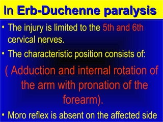 IInn EErrbb--DDuucchheennnnee ppaarraallyyssiiss 
• The injury is limited to the 5th and 6th 
cervical nerves. 
• The characteristic position consists of: 
( Adduction and internal rotation of 
the arm with pronation of the 
forearm). 
• Moro reflex is absent on the affected side 
 