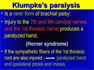 KKlluummppkkee''ss ppaarraallyyssiiss 
• Is a rarer form of brachial palsy; 
• Injury to the 7th and 8th cervical nerves 
and the 1st thoracic nerve produces a 
paralyzed hand, 
(Horner syndrome) 
• If the sympathetic fibers of the 1st thoracic 
root are also injured : paralyzed hand 
and ipsilateral ptosis and miosis. 
 