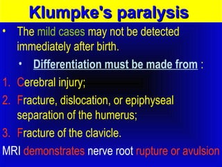 KKlluummppkkee''ss ppaarraallyyssiiss 
• The mild cases may not be detected 
immediately after birth. 
• Differentiation must be made from : 
1. Cerebral injury; 
2. Fracture, dislocation, or epiphyseal 
separation of the humerus; 
3. Fracture of the clavicle. 
MRI demonstrates nerve root rupture or avulsion 
 