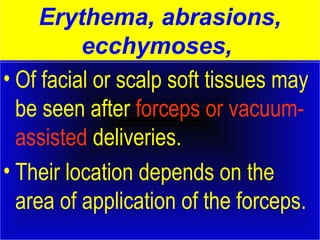 Erythema, abrasions, 
ecchymoses, 
• Of facial or scalp soft tissues may 
be seen after forceps or vacuum-assisted 
deliveries. 
• Their location depends on the 
area of application of the forceps. 
 
