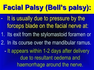 FFaacciiaall PPaallssyy ((BBeellll’’ss ppaallssyy)):: 
- It is usually due to pressure by the 
forceps blade on the facial nerve at: 
1. Its exit from the stylomastoid foramen or 
2. In its course over the mandibular ramus. 
- It appears within 1-2 days after delivery 
due to resultant oedema and 
haemorrhage around the nerve. 
 