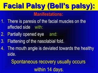 FFaacciiaall PPaallssyy ((BBeellll’’ss ppaallssyy)):: 
Manifestations: 
1. There is paresis of the facial muscles on the 
affected side with: 
2. Partially opened eye and: 
3. Flattening of the nasolabial fold. 
4. The mouth angle is deviated towards the healthy 
side. 
Spontaneous recovery usually occurs 
within 14 days. 
 
