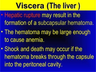 VViisscceerraa ((TThhee lliivveerr )) 
• Hepatic rupture may result in the 
formation of a subcapsular hematoma. 
• The hematoma may be large enough 
to cause anemia. 
• Shock and death may occur if the 
hematoma breaks through the capsule 
into the peritoneal cavity. 
 