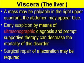 VViisscceerraa ((TThhee lliivveerr )) 
• A mass may be palpable in the right upper 
quadrant; the abdomen may appear blue. 
• Early suspicion by means of 
ultrasonographic diagnosis and prompt 
supportive therapy can decrease the 
mortality of this disorder. 
• Surgical repair of a laceration may be 
required. 
 