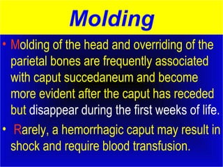 Molding 
• Molding of the head and overriding of the 
parietal bones are frequently associated 
with caput succedaneum and become 
more evident after the caput has receded 
but disappear during the first weeks of life. 
• Rarely, a hemorrhagic caput may result in 
shock and require blood transfusion. 
 