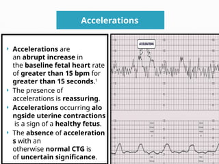 Fetal Monitoring of 2nd yr ncm109 .pptx